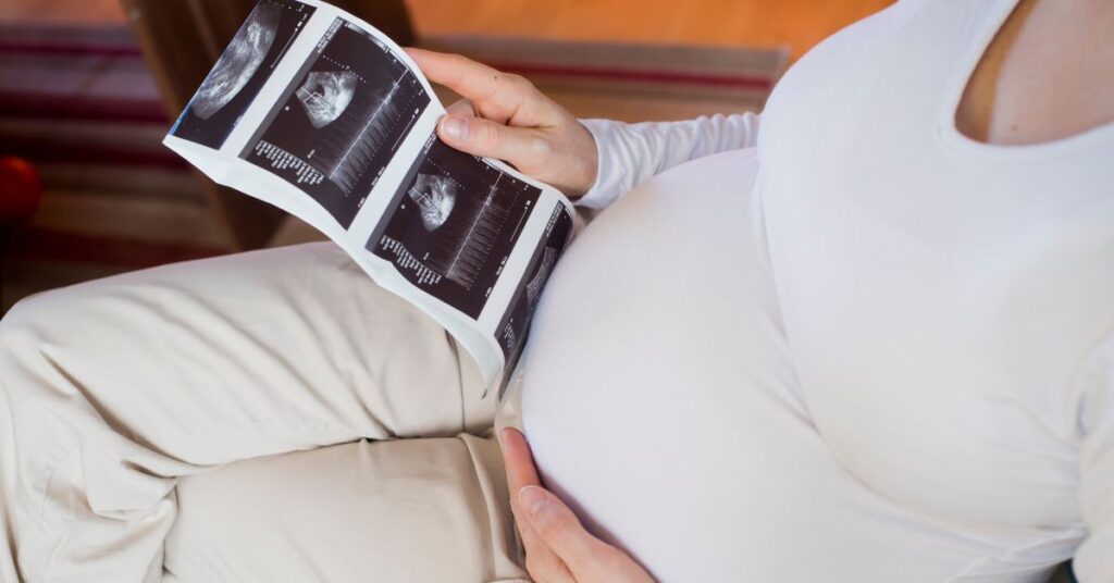 trudnoca ljeti i zimi