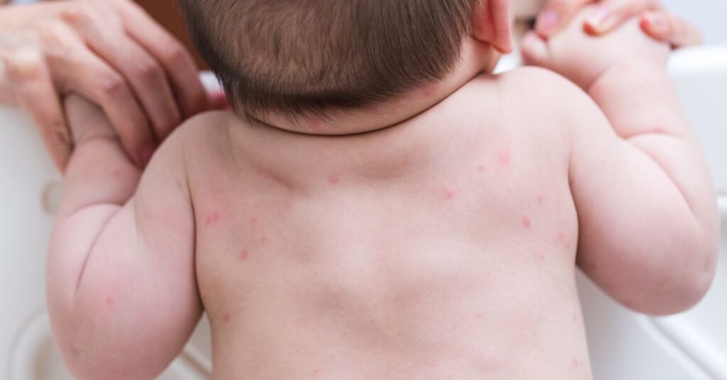 hipoalergeni proizvodi za bebe